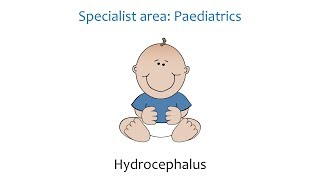 Paediatric Hydrocephalus [upl. by Hait]