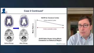 AlzheimersDisease AD updates led by Drs McConathy amp Rabinovici  bitlyADPET24Y [upl. by Ikkaj613]