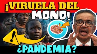 ALERTA ⚠️ VIRUELA DEL MONO LA AMENAZA GLOBAL QUE AVANZA  ¿QUÉ CARACTERÍSTICAS TIENE [upl. by Daenis]