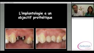 Commencer en Implantologie [upl. by Orapma]