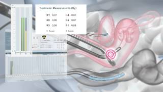 Eckert amp Ziegler BEBIG The SagiNova® Afterloader for HDR Brachytherapy [upl. by Zela507]