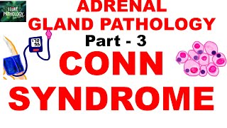 Adrenal Gland Pathology Part 3 HYPERALDOSTERONISM CONN SYNDROME [upl. by Russ]