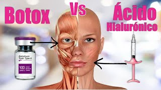 BOTOX vs ÁCIDO HIALURÓNICO ❤️💛💚💙 ADIOS ARRUGAS 💋 USOS 🔥 Dra MARISSA CHARAJA  HM Aesthetic y láser [upl. by Ycak]