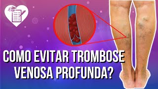 TROMBOSE VENOSA PROFUNDA  Causas Sintomas e Tratamento [upl. by Nodab]