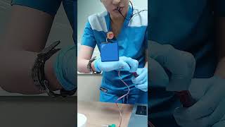 Dorsal hand vein blood collection w winged infusion set phlebotomy medicaltechnology laboratory [upl. by Ronn]