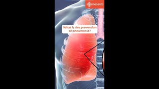 What is the Prevention OF PNEUMONIA  World Pneumonia Day  Dr Pinky Goyal  Medanta Gurugram [upl. by Ury662]