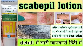 Scabepil lotion  permethrin lotion  useapply methodside effects पूरी जानकारी हिंदी में । [upl. by Billat]