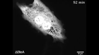 BteA Secreted from the Bordetella bronchiseptica Type III Secetion System Induces Necrosis through [upl. by Eneluj]