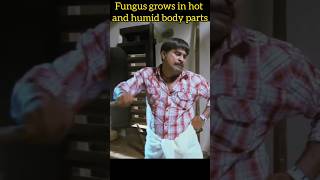 FUNGAL INFECTION😵‍💫🥴 fungi reelsinstagram skin trendingreels skin reelsvideo trending [upl. by Waylon]