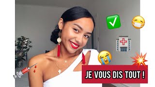 Opération des dents de sagesse  JE VOUS DIS TOUT  😱 [upl. by Desi515]