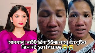 নাইট ক্রিমের ভয়াবহ ইফেক্টে মুখের ১২ টা বেজে গেল side effect of night cream  khadija begum [upl. by Anerom]