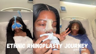 ETHNIC RHINOPLASTY  DR BORA OK  part two [upl. by Zetnas803]