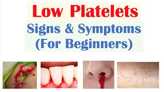 Low Platelets Signs amp Symptoms Basics for Beginners [upl. by Modnar]