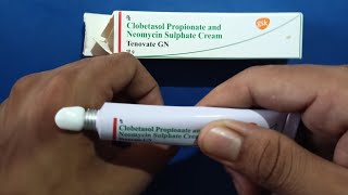 Tenovate gn cream use fungal infection ke liy dad khaj Khujli ke best creamskin global cream india [upl. by Alguire]