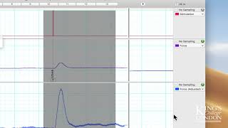 Extracting and Plotting data with a variable baseline in LabChart to Prism [upl. by Hetty137]