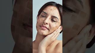 One pharmacy cream that treats 10 problems of skin skincaretips skincare skincareroutine reel [upl. by Anier]