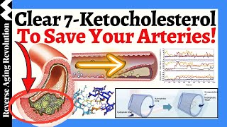 Clear 7Ketocholesterol To SAVE Your Arteries A NOVEL Approach To Heart Health [upl. by Bjork]