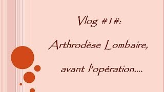 Vlog 1 Arthrodèse Lombaire avant lopération [upl. by Hapte]