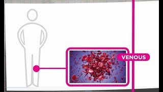 Venous Thrombosis Explained [upl. by Ekyt]