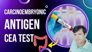 What is CEA test in Hindi  CEA ब्लड टेस्ट क्या है और क्यों करवाया जाता है Carcino Embryonic Antigen [upl. by Helgeson]