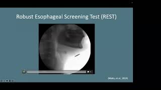 The ‘Anatomy’ of Esophageal Dysphagia Current State and Future Direction [upl. by Llertnauq]