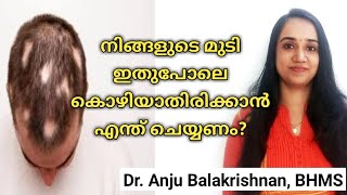 Alopecia areata in malayalam  Hair loss treatment in malayalam  Home remedies for alopecia areata [upl. by Eiduj]