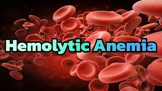 Hemolytic Anemia updated 2023  CRASH Medical Review Series [upl. by Cherilynn]