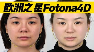 【皮肤医生张琳琳】欧洲之星Fotona4Dpro医美抗衰疗程真实记录原相机效果对比！ [upl. by Olmsted509]