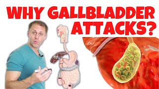 Understanding Gallbladder Attacks [upl. by Ahsekam]