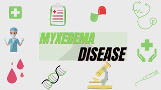 Myxedema Definition Symptoms Diagnosis Treatment [upl. by Emearg]