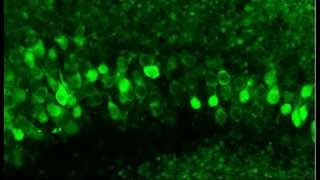 Monitoring neuronal activity in brain slices from a 2 year old Thy1GCaMP3 transgenic mouse [upl. by Airehtfele]