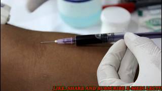 बल्ड कलेक्शन का आसान तरीका Blood collection technique Blood sample collection procedure [upl. by Nosam]