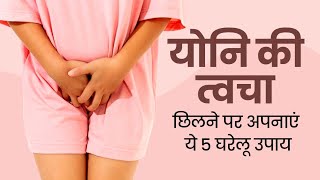 Natural Home Remedies to Get Rid from Itchy Private Parts  How to Treat Fungal Infections खुजली [upl. by Joella]