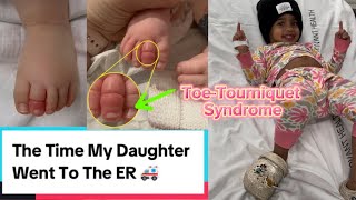 The Time My Daughter Went To The ER Toe Tourniquet Syndrome parent toddlers funny goodjobdad [upl. by Amatruda368]