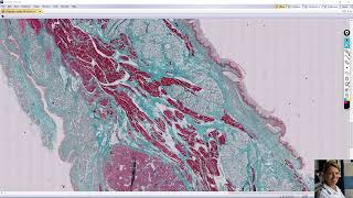 soft palate palatum molle [upl. by Januisz]