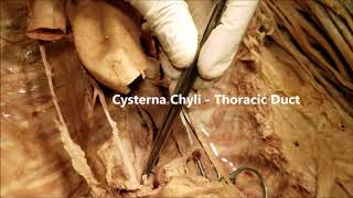 AZYGOS V THORACIC DUCT VAGUS Posterior Mediastinum and Clinical Aspects – Sanjoy Sanyal [upl. by Yehudit]