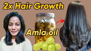 I Tried AMLA OIL for 60 Days  Before and After results 😱 [upl. by Danita]