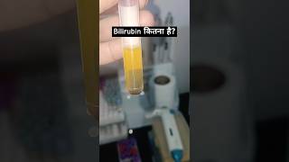 lab technician status how much is bilirubin statusbillirubin medicalstudent lab shorts serum [upl. by Natsrik]