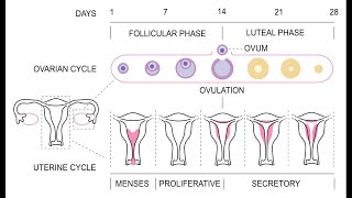 Amenorrhea  Definition Causes Signs and Symptoms Investigation and Management [upl. by Gwenny226]