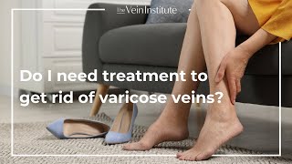 Treatment vs AtHome Care for Varicose Veins [upl. by Shyamal]