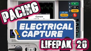 Stat Skills Transcutaneous Pacing Using the LifePak 20 [upl. by Dnalor]