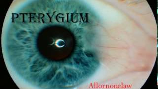 pterygium surfers eye Medical video lecture ophthalmology [upl. by Fitzsimmons]