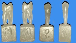 Carving of maxillary first premolar [upl. by Eleirbag]