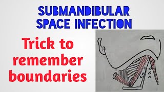 Submandibular space infection  trick to remember boundaries [upl. by Froemming]