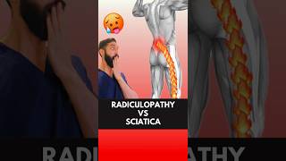 The Truth About Radiculopathy VS Sciatica Revealed [upl. by Ynnoj]