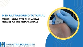 MSK ultrasound evaluation of the medial and lateral plantar nerves [upl. by Low]