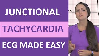 Junctional Tachycardia ECG Interpretation Made Easy for NCLEX Nursing School [upl. by Jamesy486]