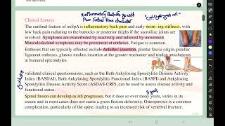 Rheumatology L5 Spondyloarthropathies p13 axial SA [upl. by Nared]