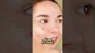 How to Treat Acne with These Natural Herbs shorts acnetreatment [upl. by Annahaj]