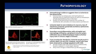 Indications Cervical Spondylotic Myelopathy  Benjamin Kafka MD [upl. by Naujit985]